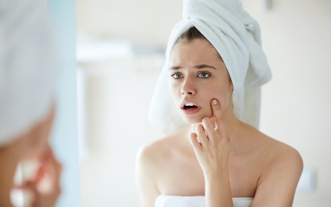 Emergency Skincare: Managing Sudden Skin Outbreaks Before a Big Day